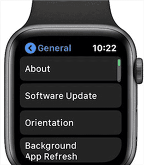 Apple Watch Keeps Restarting