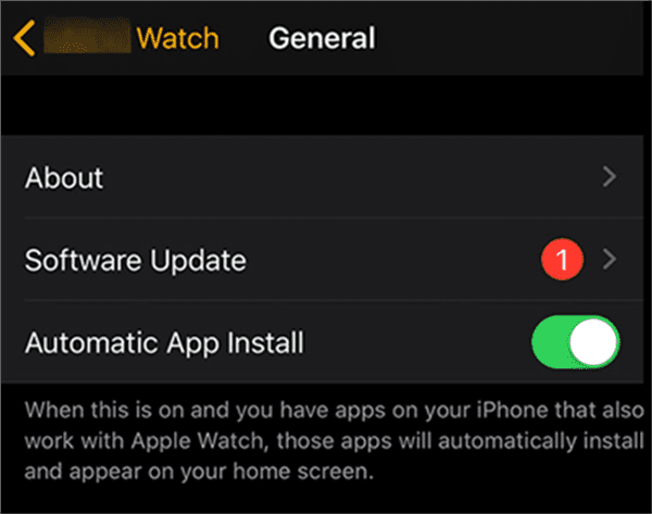 Apple Watch Keeps Restarting